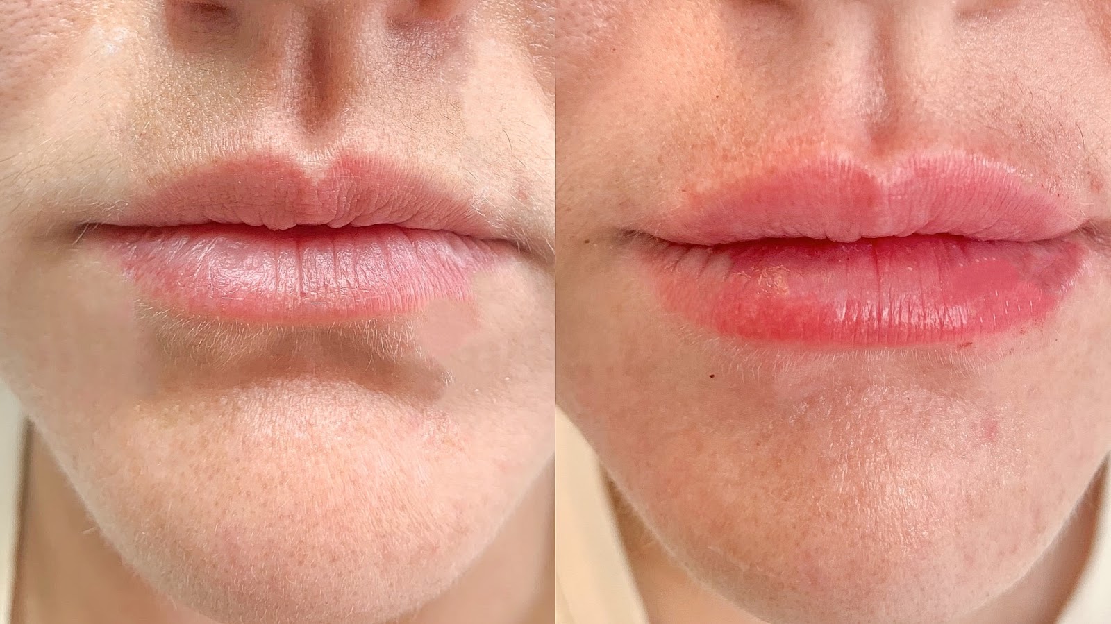 Anew You Aesthetics And Med Spa — Wellness Spot in West Ashley, Charleston, SC